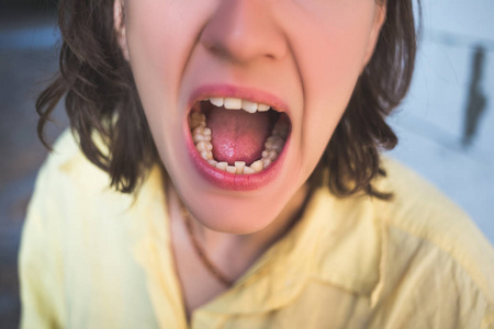 歪歪女人牙齿歪歪的照片照片