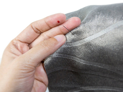 缝针导致手指意外出血图片