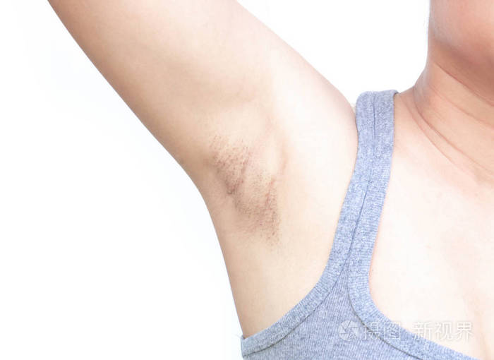 女性问题白底黑腋窝护肤美容理念