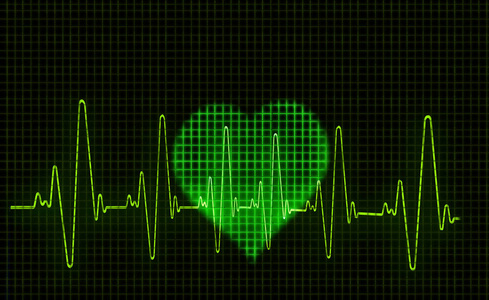 心电图波动图片