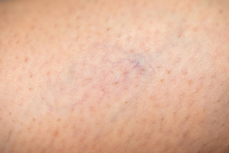 金球织蜘蛛图片