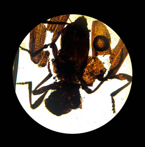 显微镜下的蜱虫图片