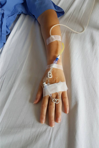 滴针病人手上有滴管输液针进行静脉输液.照片