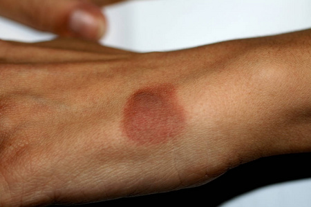 手上的褐色斑点.皮肤上的色素斑豹斑皮肤单色背景.黑暗动物无缝图案.