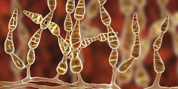 链格孢霉,过敏性真菌照片