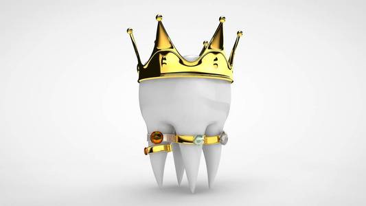 一颗带有金冠和宝石戒指的白色人类牙齿的三维渲染.
