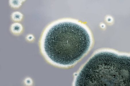 青霉菌菌落在沙氏葡萄糖琼脂上的研究照片