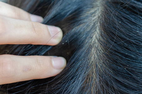 的小孩患有食物过敏虱子鸡蛋关-在上面脓肿向小孩皮恶心的小孩身体,胃