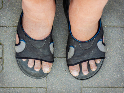 穿着人字拖的脏老头脚照片