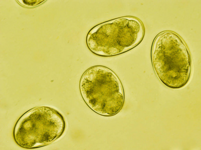 钩虫镜下圆线虫卵,钩蚴钩虫,钩照片