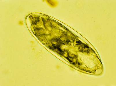 显微镜下有幼虫的跳蚤卵照片