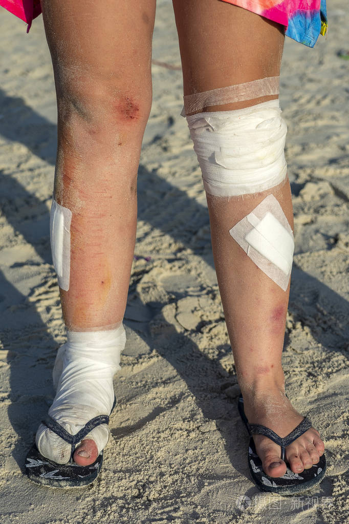 闭合照片-正版商用图片2lyz3n-摄图新视界