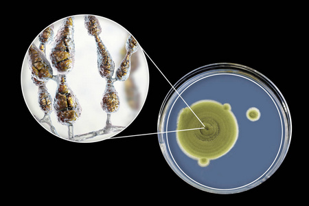 糖链交替链格孢菌在营养培养基上的菌落图解和照片照片