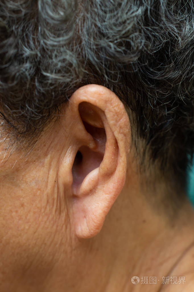 老年女性左耳听力听力损失症状特写和宏观拍摄选择性聚