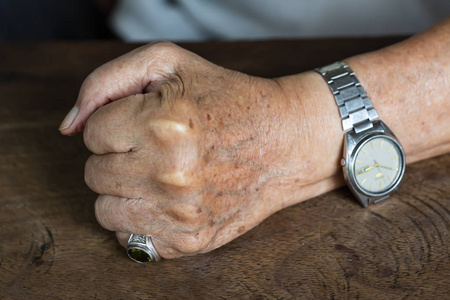 老人左手握拳在木桌背景上,痣和瑕疵,特写和宏拍,选择性聚焦,亚洲身体