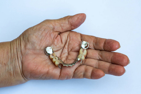 牙科集高级妇女手拿假牙,丙烯酸和维生素金属,白底,口腔科和假牙集