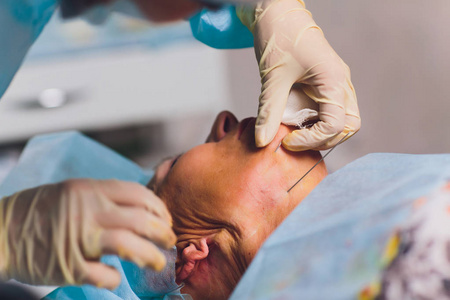 丝妇女老年妇女做中丝和提线,美容.消除衰老迹象的整容手术.
