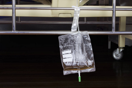 医院病床下悬挂塑料尿袋照片