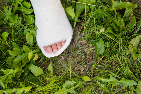 户外活动游戏.上面的石膏腿.那个事故的后果.