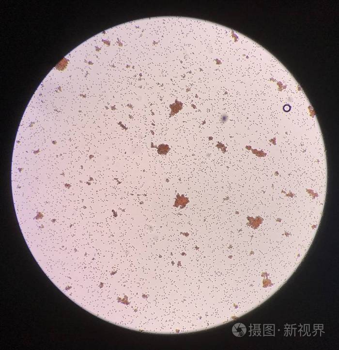 交叉配血试验中红细胞凝集不相容