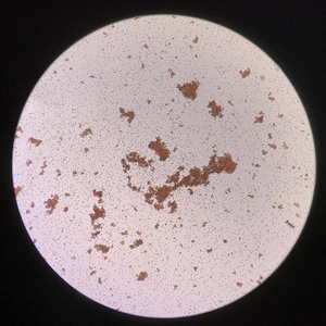 交叉配血试验中红细胞凝集不相容照片