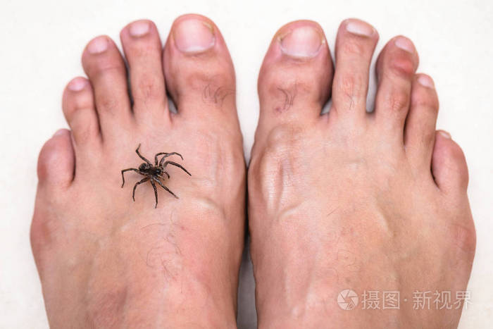 棕色蜘蛛袭击人.毒蜘蛛咬脚,蜘蛛咬,毒兽咬.蜘蛛恐惧症.照片-正版商用