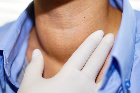 喉咙 甲亢 结节 群众 过度活跃 甲状腺肿 肿瘤 照顾 职业照片