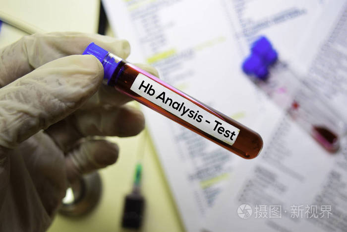 血红蛋白分析用血样检测顶视图隔离在办公桌上医疗保健医疗概念