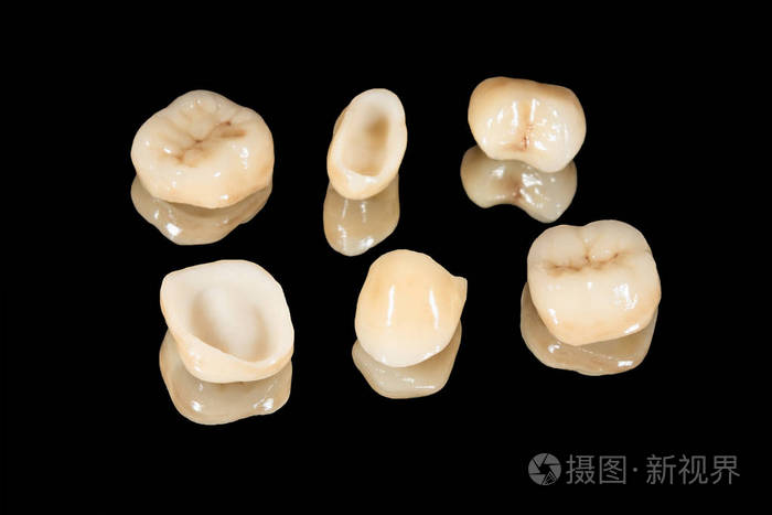 人类牙齿的陶瓷冠在黑色b上的特写宏隔离