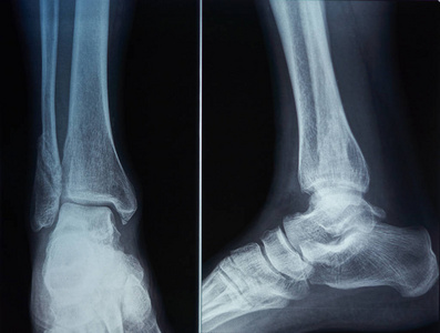 脚的骨骼扫描无缝的榜样和黑的动物脚印和骨骼.脚趾x光片.