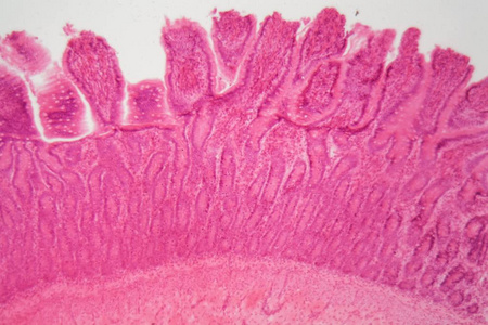 单层柱状上皮小肠绒毛图片