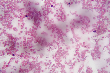 显微镜寄生虫人类血液与布氏锥虫的显微镜照片一种非洲锥虫病的寄生虫