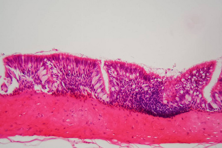 显微镜下纤毛上皮.照片