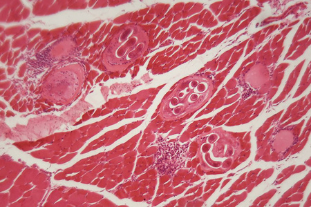 肉组织显微镜下肌肉组织中旋毛虫幼虫.照片