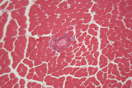 旋毛虫病显微镜下肌肉组织中旋毛虫幼虫.照片