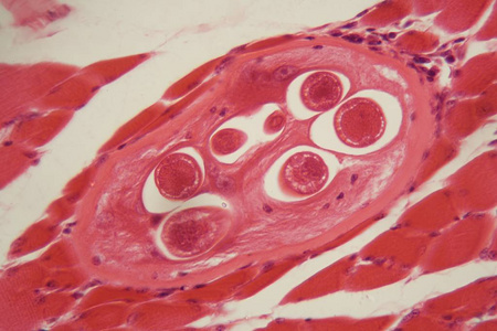 旋毛虫囊包显微镜图片