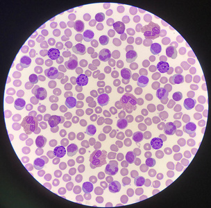 混合成熟白细胞在红细胞背景上.照片