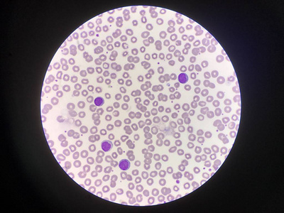 造血系统红细胞背景成熟淋巴细胞.照片