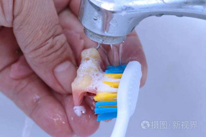 用牙刷清洁牙齿局部义齿