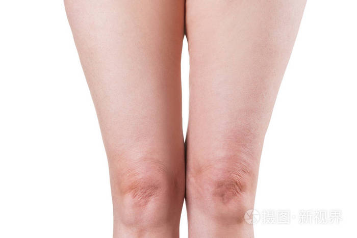 女性腿部松弛的皮肤年长女性的膝盖孤立在白色背景上