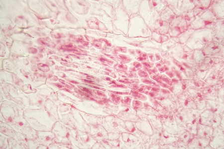 显微镜下的根瘤菌.照片