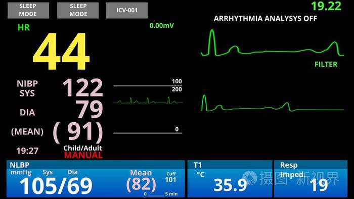 脉搏低的病人医学生命体征监测心脏传感器诊断