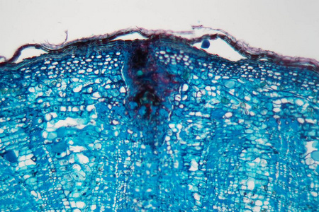 显微镜下有病的植物干细胞照片