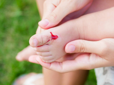 纸巾上有血那孩子的腿受伤了.这个女孩为她的孩子提供急救.