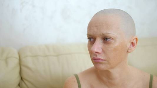 害怕的船名空难幸存者抑郁悲伤的秃头妇女癌症化疗后.坐在沙发上哭.