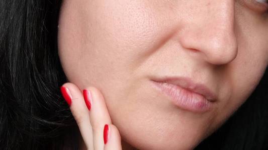 毛孔粗大的皮肤纹理.女孩摸了摸脸上有问题的皮肤的手指,想了想.