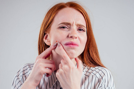 挤痘痘模型图片