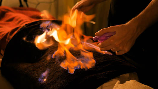 中医按摩师中医火疗照片