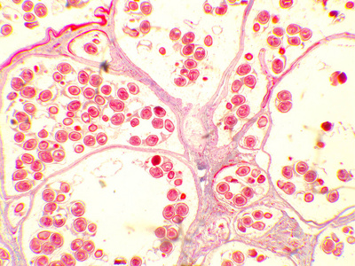 细粒棘球绦虫.犬绦虫寄生虫.照片