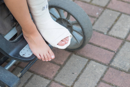 选择性聚焦.复制空间.残疾人轮椅人.孩子在骨折的腿上打石膏花园.